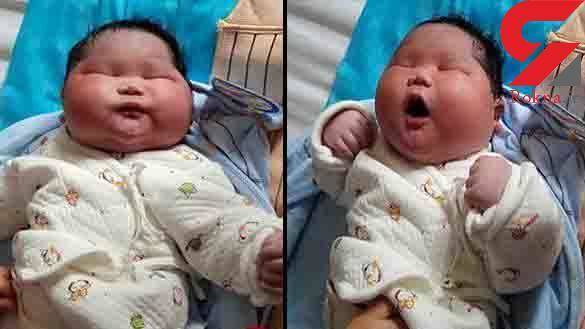 تولد نوزاد عجیب در چین +عکس