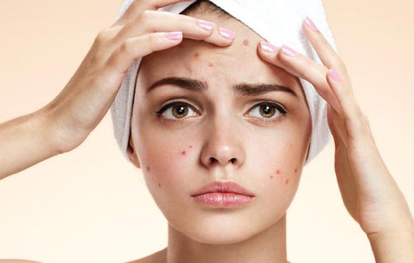 با قرص راکوتان و عوارض آن آشنا شوید