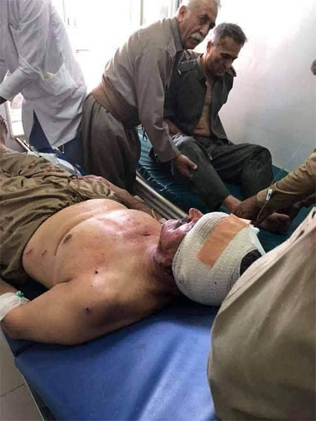 حمله موشکی سپاه به مقر حزب دموکرات کردستان +عکس و فیلم حمله موشکی سپاه به مقر حزب دموکرات کردستان +عکس و فیلم