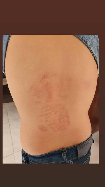 تایید تنبیه بدنی یک دانش آموز در شیراز/معلم رسمی نیست + عکس