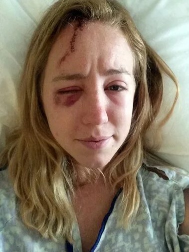 حس تازه‌ای که اصابت رعد و برق در این زن ایجاد کرد!