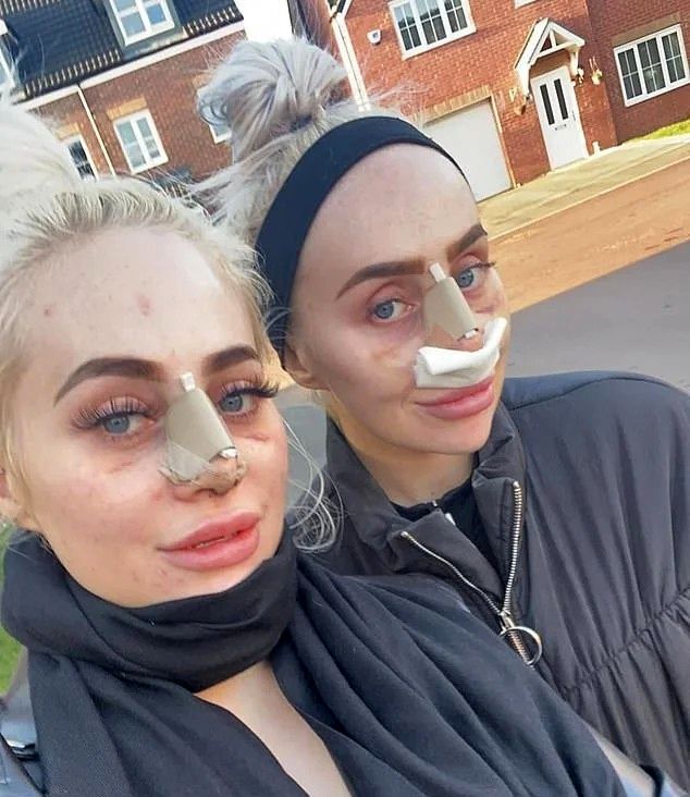 هزینه ۲۰۰,۰۰۰ دلاری دختران دوقلو برای شبیه عروسک باربی شدن