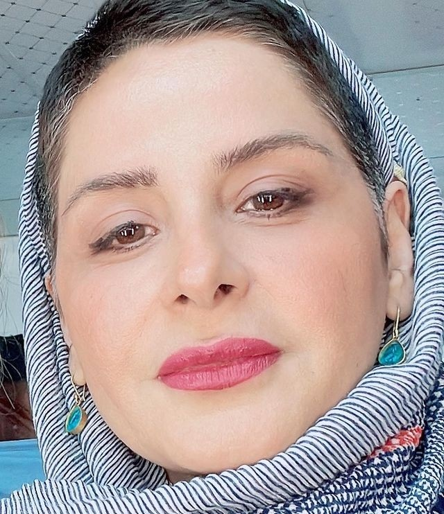 تغییر چهره عجیب سیما تیرانداز+ عکس تغییر چهره عجیب سیما تیرانداز+ عکس